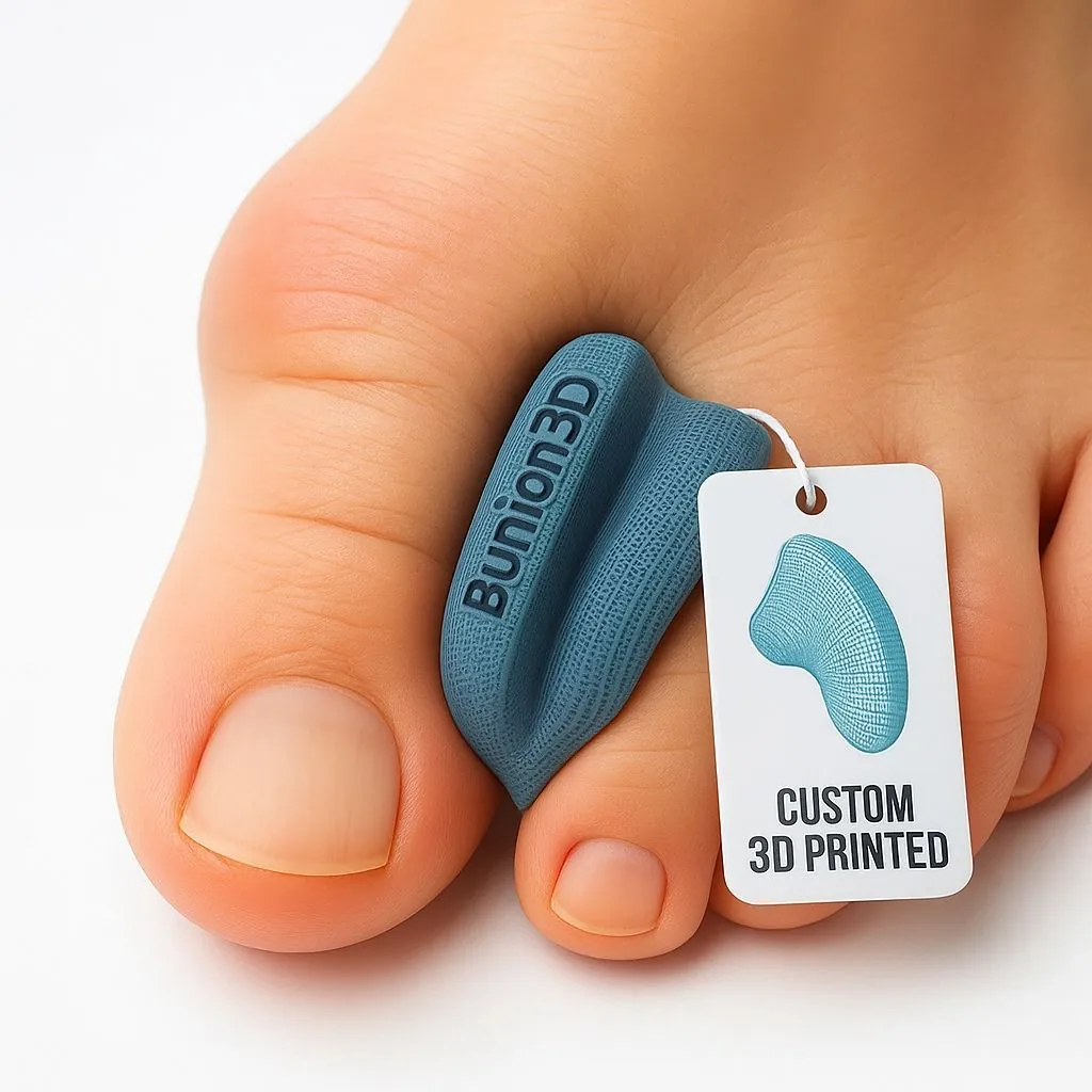 Bunion3D personalised toe separator